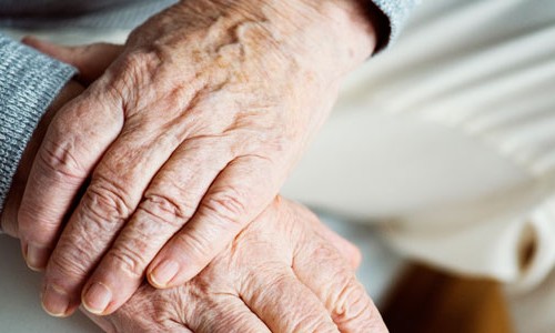 Cuidado Para Nao Perder O Seu Benefico