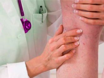 Pessoa Com Trombose Venosa Pode Pedir O Bpc Loas